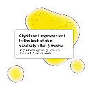 The Ordinary Cold Pressed Rose Hip Seed Oil