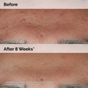 The Ordinary Niacinamide 10%+Zinc1%