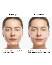 Clinique by Clinique Clinique Smart Clinical MD Multi-Dimensional Age Transformer -50ml