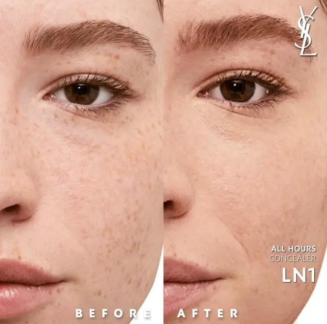 ln1.webp